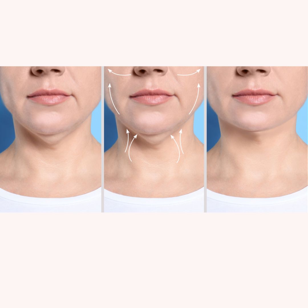 Three chin images in one frame of women