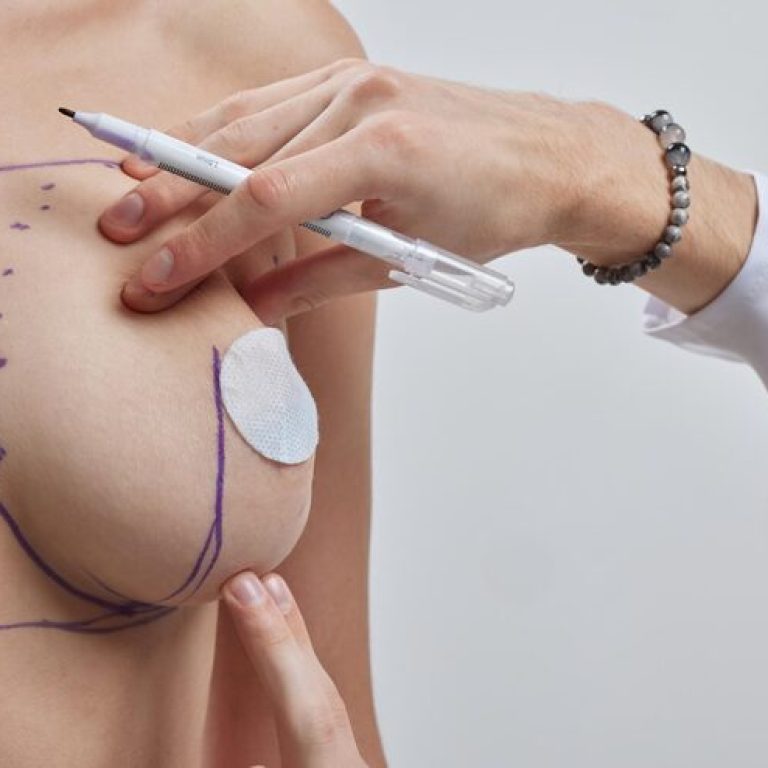 doctor-hand-drawing-lines-woman-breast-breast-implant-surgery-concept_627378-8053