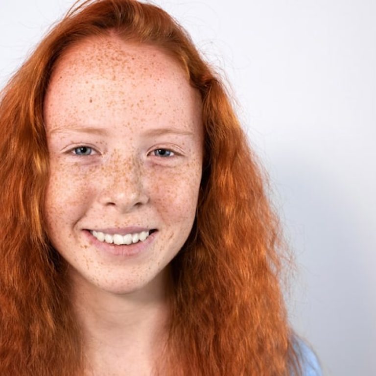 portrait-red-haired-girl-with-lots-freckles-face-blue-eyes-white_1268-16040
